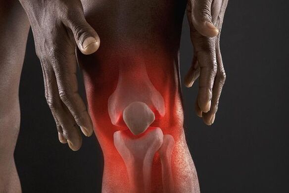 Symptômes d'arthrose